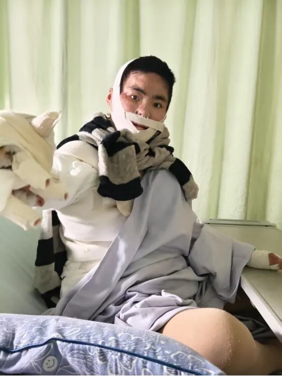深度调查｜恋爱3年分手遭燃火报复，女孩身残凶手仅获刑12年？